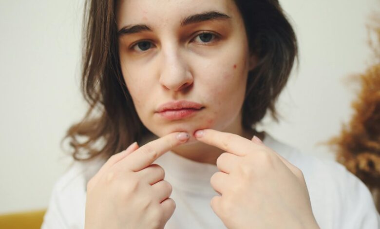 remove dark spots naturally